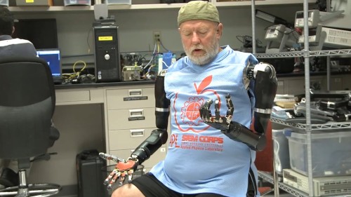 Double Prosthetic Arm with Mind Control